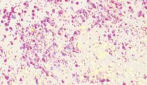 KNORR PRANDELL 218099100 Glitterfarbe Flaky Glue weiss